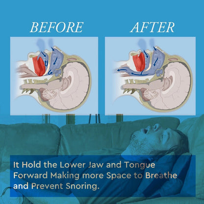 Stop Snoring Mouthpiece Sleep Apnea Guard Bruxism Anti Snore Pure Grind Aid Tray